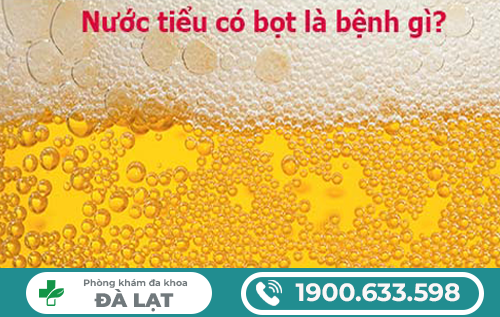 Hình ảnh minh họa